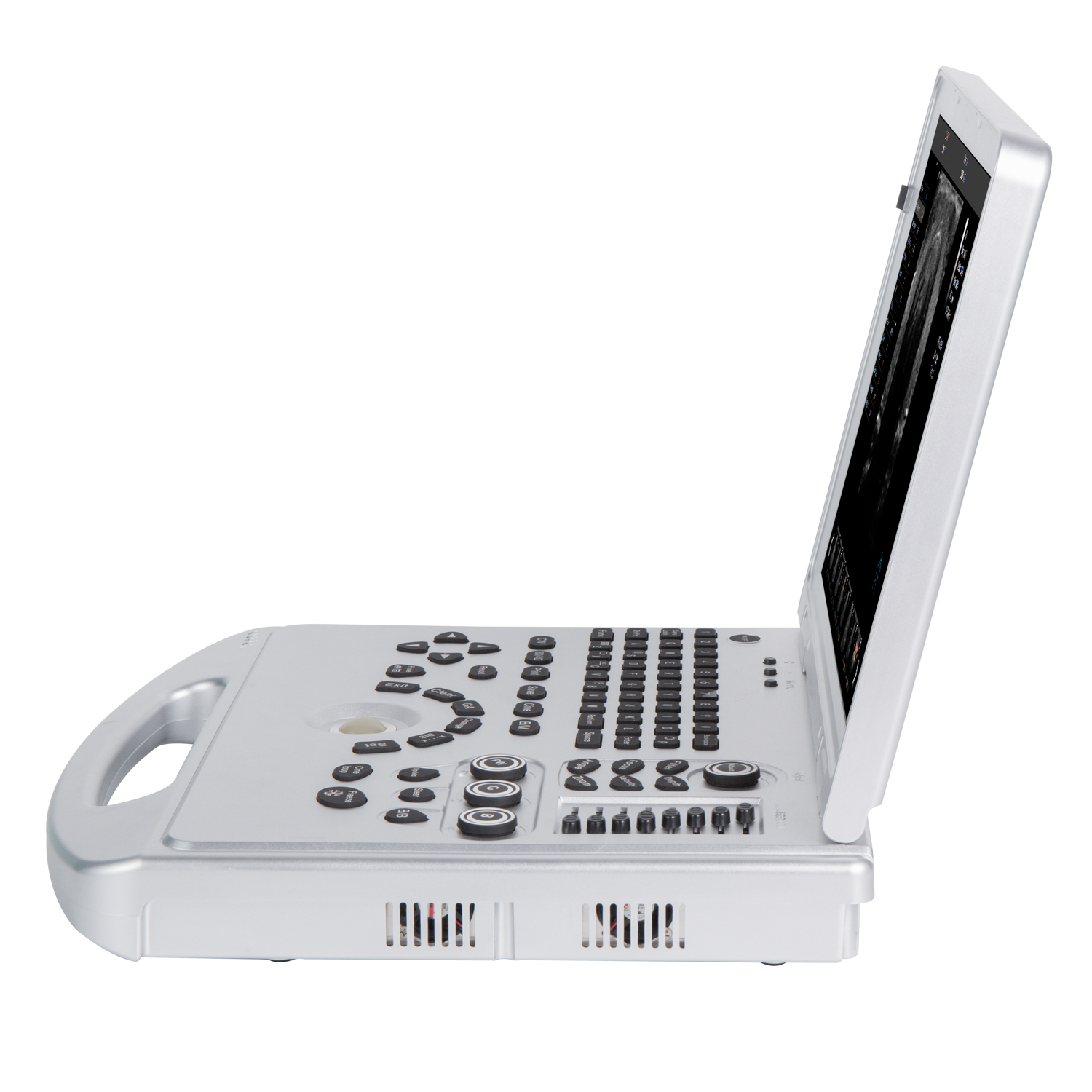 Portable Laptop-type Color Doppler Ultrasound Systemfor Clinical Diagnostics