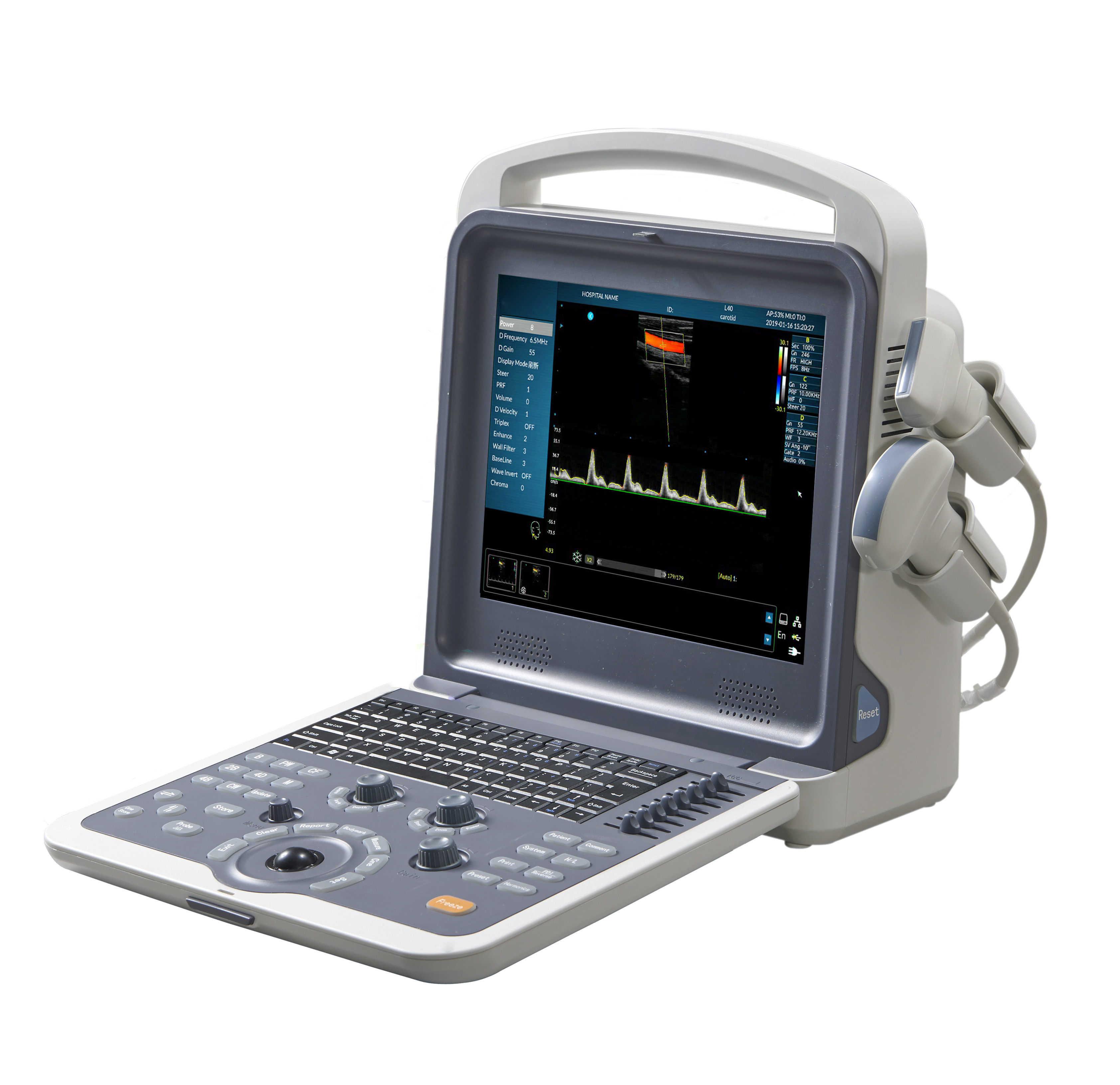 Portable Color Doppler Ultrasound Machine