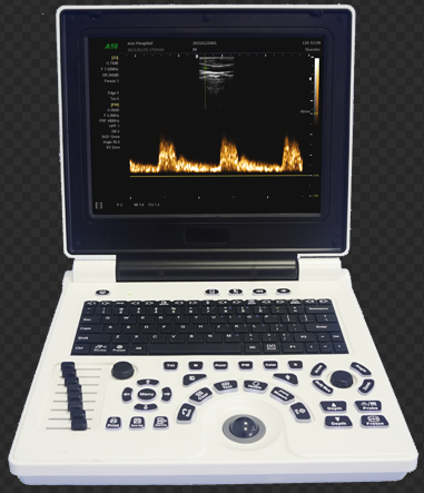 A10 B/W Ultrasound Diagnostic System