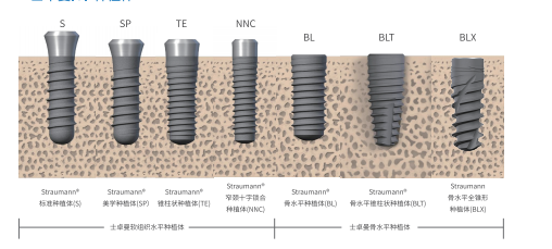 Straumann ITI implant